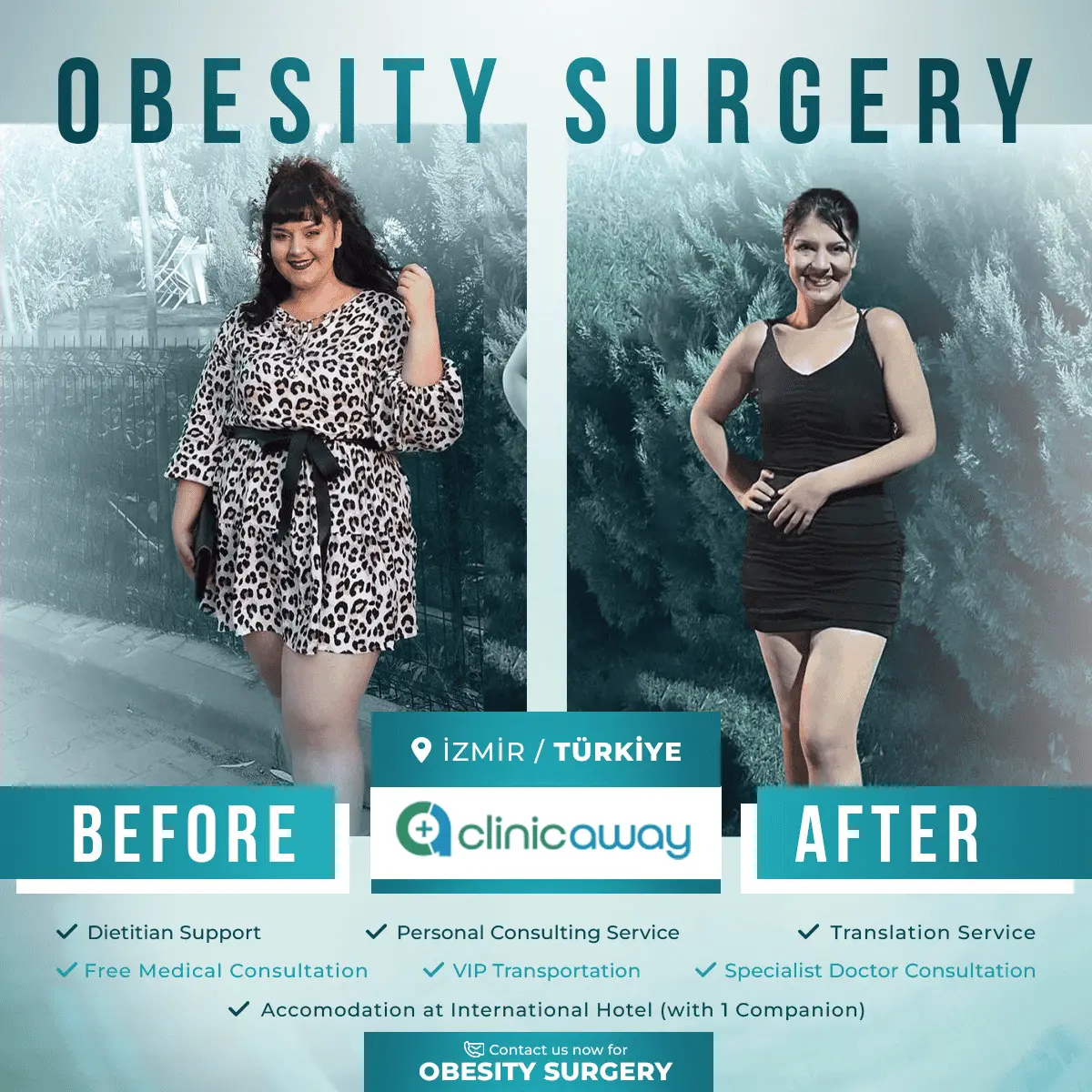 0-OBESITY-SURGERY.webp