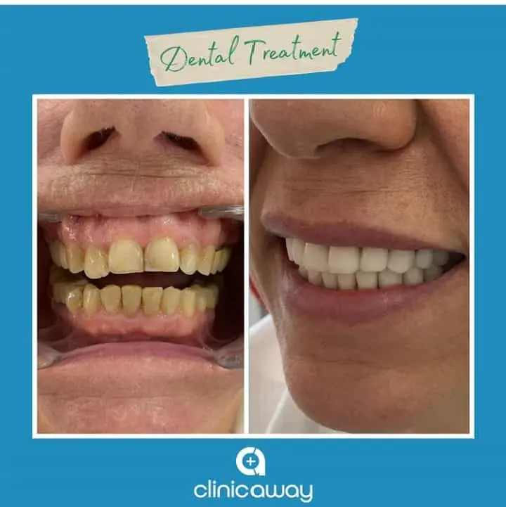1-Dental.webp