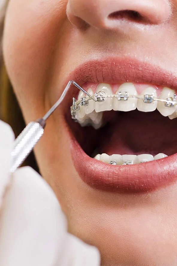 Orthodontics