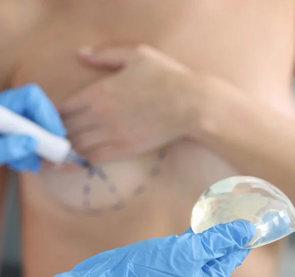 PLASTIC SURGERY